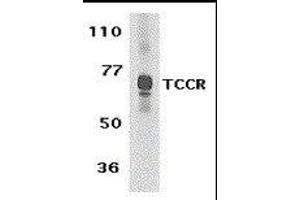 Western Blotting (WB) image for anti-Interleukin 27 Receptor, alpha (IL27RA) (C-Term) antibody (ABIN2474995) (IL27 Receptor alpha 抗体  (C-Term))