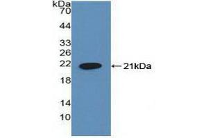 Detection of Recombinant HLTF, Human using Polyclonal Antibody to Helicase Like Transcription Factor (HLTF) (HLTF 抗体  (AA 837-996))