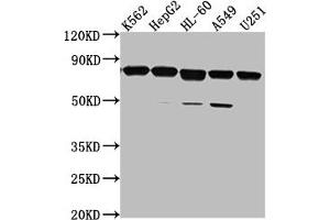 Western Blot Positive WB detected in: K562 whole cell lysate, HepG2 whole cell lysate, HL-60 whole cell lysate, A549 whole cell lysate, U251 whole cell lysate All lanes: TMEM214 antibody at 1:2000 Secondary Goat polyclonal to rabbit IgG at 1/50000 dilution Predicted band size: 78, 73 kDa Observed band size: 78 kDa (TMEM214 抗体  (AA 2-236))
