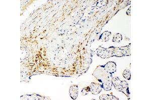 Immunohistochemistry (IHC) image for anti-Solute Carrier Family 16 (Monocarboxylic Acid Transporters), Member 4 (SLC16A4) (AA 134-148), (N-Term) antibody (ABIN3044003)