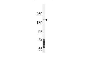 Western Blotting (WB) image for anti-Nitric Oxide Synthase 2, Inducible (NOS2) (AA 830-860) antibody (ABIN655717)
