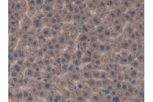 Detection of FGFRL1 in Rat Liver Tissue using Polyclonal Antibody to Fibroblast Growth Factor Receptor Like Protein 1 (FGFRL1) (FGFRL1 抗体  (AA 164-368))