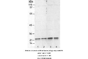 Image no. 2 for anti-Caveolin 1, Caveolae Protein, 22kDa (CAV1) antibody (ABIN363230) (Caveolin-1 抗体)