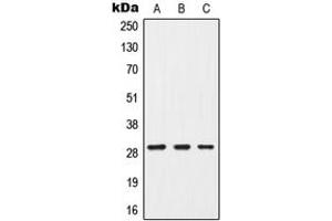 Western blot analysis of G18 expression in MCF7 (A), mouse brain (B), PC12 (C) whole cell lysates. (GPSM3 抗体  (Center))