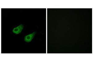 Immunofluorescence analysis of HeLa cells, using JIP3 antibody. (JIP3 抗体  (Internal Region))