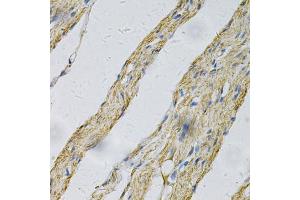 Immunohistochemistry of paraffin-embedded human smooth muscle using PRNP Antibody (ABIN5971407) at dilution of 1/100 (40x lens). (PRNP 抗体)