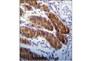 ATG5 Antibody (ABIN650657 and ABIN2849633) immunohistochemistry analysis in formalin fixed and paraffin embedded human stomach tissue followed by peroxidase conjugation of the secondary antibody and DAB staining. (ATG5 抗体)