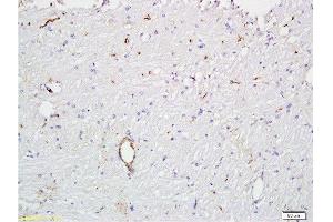 Formalin-fixed and paraffin embedded rat brain tissue  at 1:300 followed by conjugation to the secondary antibody and DAB staining. (VWF 抗体  (AA 701-800))