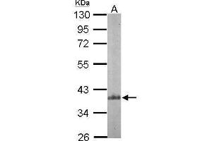 Western Blotting (WB) image for anti-Actin Related Protein 2/3 Complex, Subunit 1B, 41kDa (ARPC1B) (N-Term) antibody (ABIN2855927)