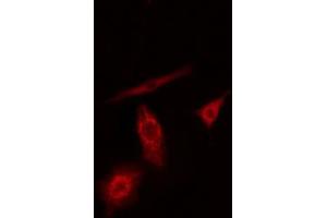 ABIN6274186 staining A549 cells by IF/ICC. (PFKL 抗体  (C-Term))