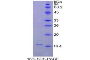 SDS-PAGE analysis of Chicken FABP1 Protein. (FABP1 蛋白)