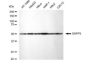 Western blotting analysis using ENPP5 antibody (ABIN7798423).