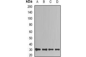 Western blot analysis of TIM expression in Jurkat (A), HepG2 (B), mouse kidney (C), mouse brain (D) whole cell lysates. (TPI1 抗体)