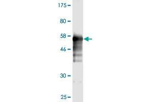 Western Blot detection against Immunogen (55. (Prohibitin 抗体  (AA 1-272))
