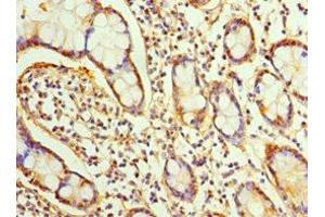 Immunohistochemistry of paraffin-embedded human small intestine tissue using ABIN7170334 at dilution of 1:100 (SRI 抗体  (AA 1-198))