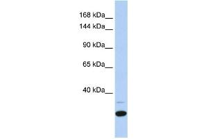 WB Suggested Anti-ZNF197 Antibody Titration:  0.
