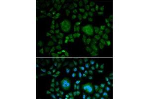 Immunofluorescence analysis of HeLa cells using CA2 Polyclonal Antibody (CA2 抗体)