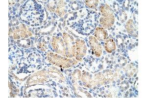 FZD7 antibody was used for immunohistochemistry at a concentration of 4-8 ug/ml to stain Epithelial cells of renal tubule (arrows) in Human Kidney. (FZD7 抗体)