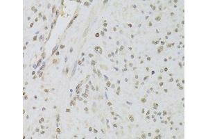 Immunohistochemistry of paraffin-embedded Human leiomyoma of uterus using RUVBL1 Polyclonal Antibody at dilution of 1:100 (40x lens). (RUVBL1 抗体)