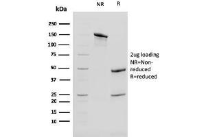 SDS-PAGE Analysis of Purified Cytokeratin 13 Mouse Monoclonal Antibody (KRT13/2213). (Cytokeratin 13 抗体)