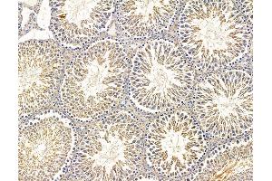 ABIN7095844 and ABIN7099906 at 1/100 staining rat testis tissue by IHC-P. (B4GALNT3 抗体)