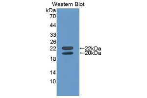 Western Blotting (WB) image for anti-Insulin-Like Growth Factor Binding Protein 3 (IGFBP3) (AA 140-271) antibody (ABIN1868520)