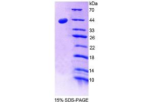 SDS-PAGE analysis of Mouse CD99 Protein. (CD99 Protein (CD99))