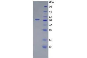SDS-PAGE analysis of Human Galectin 12 Protein. (LGALS12 蛋白)