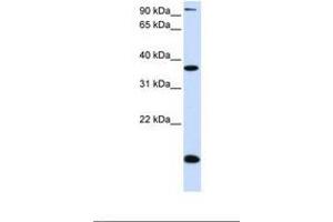 Image no. 1 for anti-Kruppel-Like Factor 8 (KLF8) (AA 74-123) antibody (ABIN6739064) (KLF8 抗体  (AA 74-123))