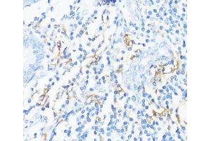 Immunohistochemistry of paraffin-embedded Human appendix using HLA-DRB3 Polyclonal Antibody at dilution of 1:100 (40x lens). (HLA-DRB3 抗体)