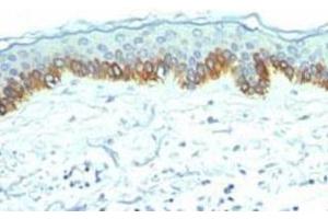 Immunohistochemical staining (Formalin-fixed paraffin-embedded sections) analysis of human skin with Cytokeratin, LMW monoclonal antibody, clone AE1  at 1:200 using peroxidase-conjugate and DAB chromogen.