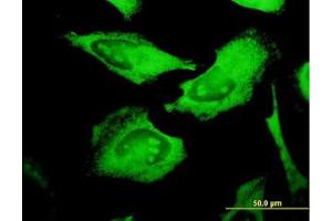 Image no. 1 for anti-Protein C Receptor, Endothelial (PROCR) (AA 1-239) antibody (ABIN599144) (PROCR 抗体  (AA 1-239))
