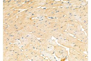 ABIN6259685 and ABIN6277180 at 1/100 staining Rat heart tissue by IHC-P. (ABCC4 抗体)