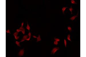 ABIN6275035 staining Hela by IF/ICC. (Complement Factor I 抗体  (Internal Region))