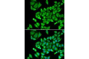 Immunofluorescence analysis of U2OS cells using DHRS9 antibody (ABIN6130324, ABIN6139603, ABIN6139604 and ABIN6221932). (DHRS9 抗体  (AA 18-319))