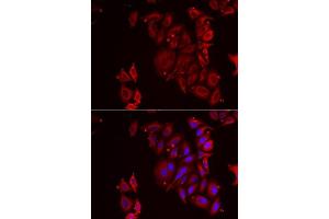 Immunofluorescence analysis of U2OS cells using PAICS antibody. (PAICS 抗体  (AA 176-425))