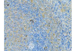Immunohistochemistry of paraffin-embedded rat slpeen using TLR4 antibody (ABIN2737696) at dilution of 1:100 (40x lens). (TLR4 抗体)