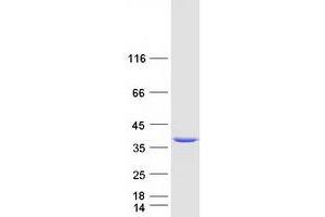 Western Blotting (WB) image for N-Acetylneuraminate Pyruvate Lyase (Dihydrodipicolinate Synthase) (NPL) protein (Myc-DYKDDDDK Tag) (ABIN2727501)