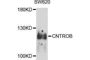 Western blot analysis of extracts of SW620 cells, using CNTROB antibody (ABIN5974543) at 1/1000 dilution. (CNTROB 抗体)