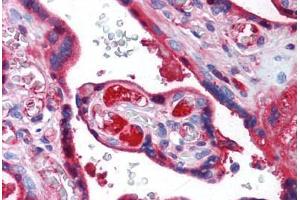 Human Placenta (formalin-fixed, paraffin-embedded) stained with TF antibody ABIN462368 followed by biotinylated anti-mouse IgG secondary antibody ABIN481714, alkaline phosphatase-streptavidin and chromogen. (Transferrin 抗体  (N-Term))