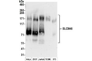 Western Blotting (WB) image for anti-Solute Carrier Family 9 (Sodium/hydrogen Exchanger), Member 6 (SLC9A6) (AA 600-650) antibody (ABIN7450742)