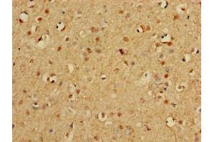 Immunohistochemistry of paraffin-embedded human brain tissue using ABIN7164952 at dilution of 1:100 (PSMA3 抗体  (AA 218-248))