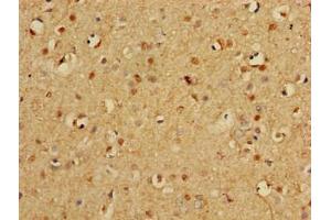Immunohistochemistry of paraffin-embedded human brain tissue using ABIN7164952 at dilution of 1:100 (PSMA3 抗体  (AA 218-248))
