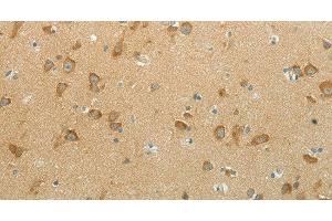 Immunohistochemistry of paraffin-embedded Human brain using NDRG3 Polyclonal Antibody at dilution of 1:70 (NDRG3 抗体)