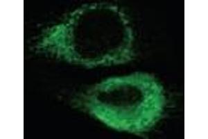 Immunofluorescence analysis of endoplasmic reticulum staining of mouse C2C12 myoblasts transfected with wild type mouse ADAM12 using KDEL (Grp78, Grp94) mAb (10C3). (KDEL 抗体  (AA 649-654))