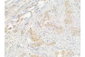 anti-Cyclin-Dependent Kinase Inhibitor 2B (p15, Inhibits CDK4) (CDKN2B) (Internal Region) antibody