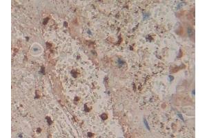 Immunohistochemistry (IHC) image for anti-Coronin, Actin Binding Protein, 1A (CORO1A) (AA 7-204) antibody (ABIN7436672)