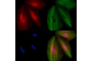 ABIN6259117 and ABIN6273494 staining  cells by IF/ICC. (MORG1 抗体  (Internal Region))