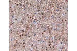Used in DAB staining on fromalin fixed paraffin- embedded brain tissue (Nischarin 抗体  (AA 1246-1346))
