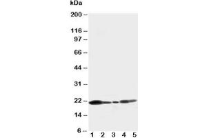Western blot testing of Caveolin-1 antibody and Lane 1:  U87;  2: HeLa;  3: MCF-7;  4: A549;  5: HT1080 cell lysate (Caveolin-1 抗体  (C-Term))
